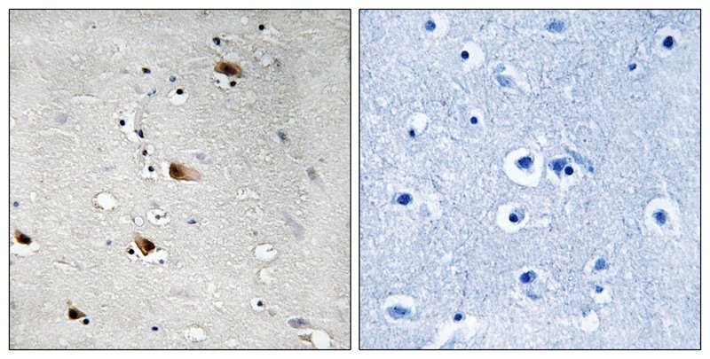 Anti-Phospho-E2A (Thr355) Polyclonal Antibody