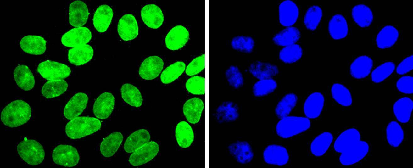 Anti-E2F1 Antibody (2K279)