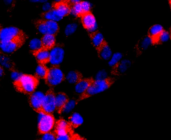 Anti-DRD1 Antibody (5S403)