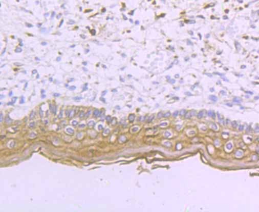 Anti-DSG1 Antibody (4J92)