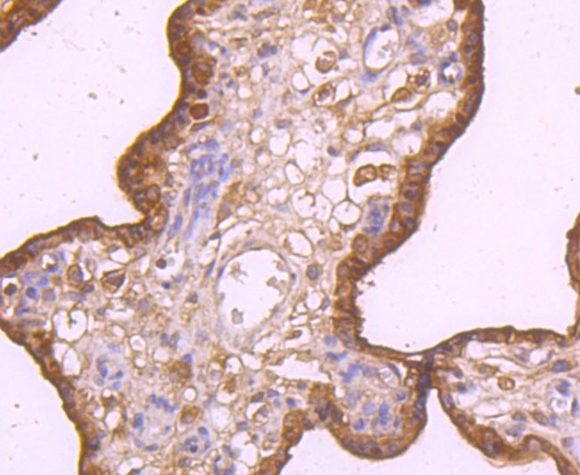 Anti-TRAIL R2/DR5/TNFRSF10B Antibody (7L7)