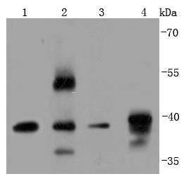 Anti-ERCC1 Antibody (7K54)