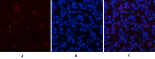 Anti-Phospho-MAPK3/1 (Thr202/Tyr204) Polyclonal Antibody