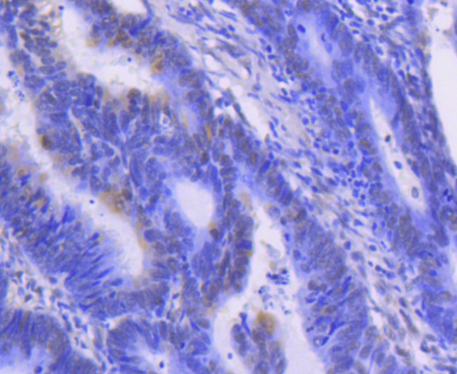 Anti-MAPK3 Antibody (1K596)