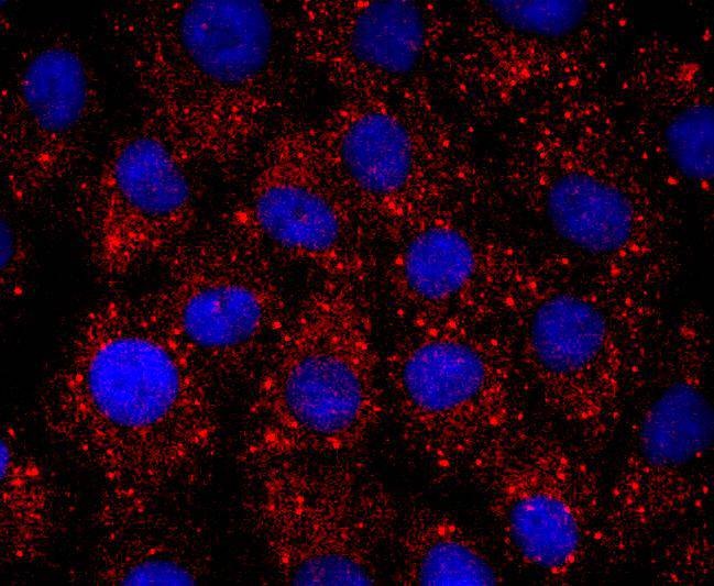 Anti-ERCC1 Antibody (7K54)