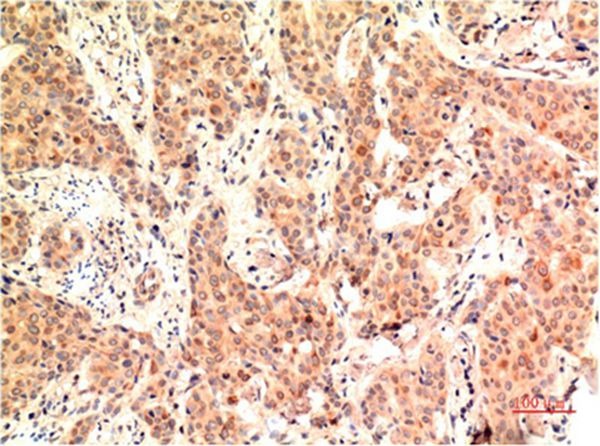 Anti-MAPK3 Antibody (8W49)