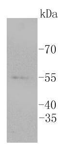 Anti-ERG Antibody (2Q359)