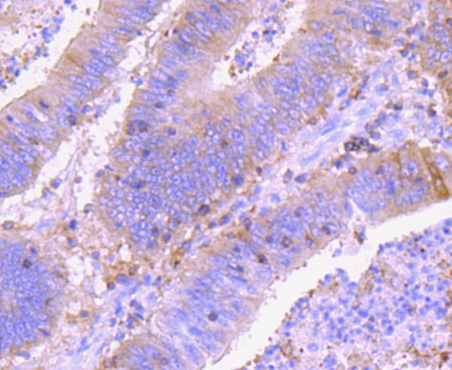 Anti-Ezrin Antibody (7A973)