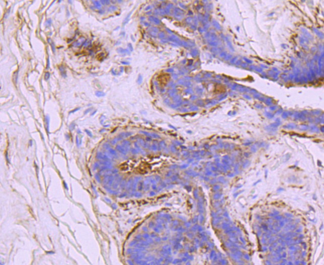 Anti-Ezrin Antibody (7A973)