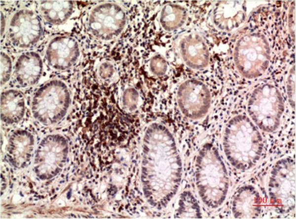 Anti-Epsilon Tubulin Antibody (8Q708)