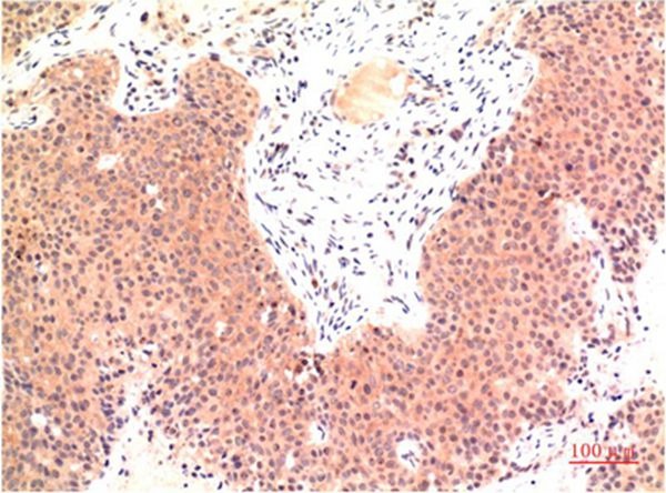 Anti-Epsilon Tubulin Antibody (8Q708)