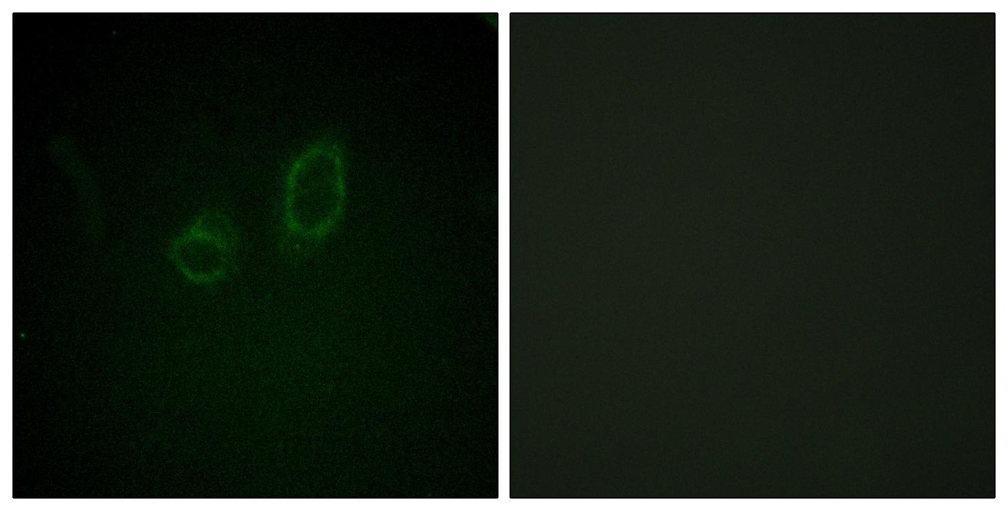 Anti-Phospho-Ezrin/Radixin/Moesin (Thr567/564/558) Polyclonal Antibody