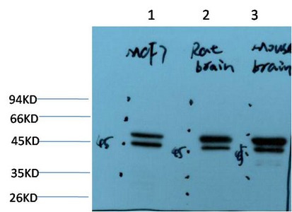 Anti-Epsilon Tubulin Antibody (9U804)