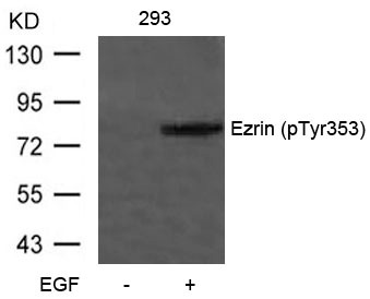 Anti-Phospho-Ezrin (Tyr353) Polyclonal Antibody