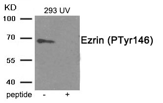 Anti-Phospho-Ezrin (Tyr146) Polyclonal Antibody