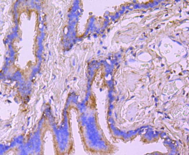 Anti-Ezrin Antibody (7A973)