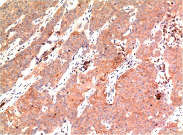 Anti-Epsilon Tubulin Antibody (3F495)