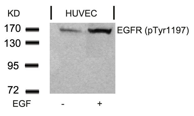 Anti-Phospho-EGFR (Tyr1197) Polyclonal Antibody