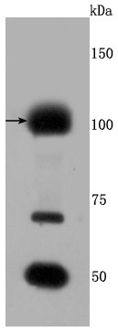 Anti-FGFR3 Antibody (7I878)