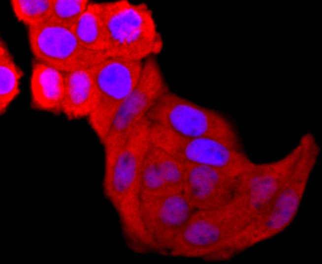 Anti-LGALS3 Antibody (1Z486)
