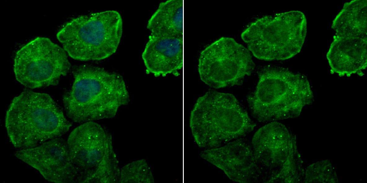 Anti-LGALS7 Antibody (2U199)