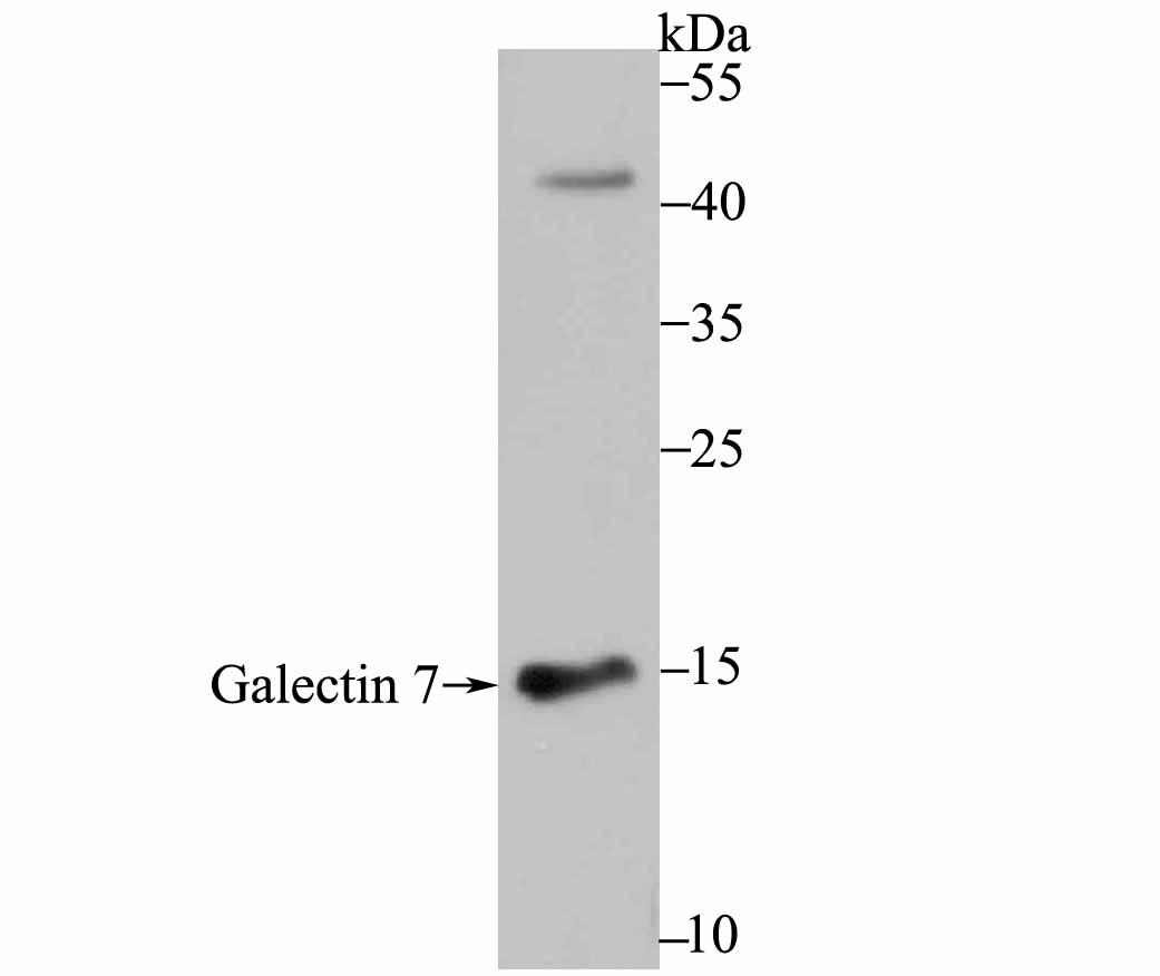 Anti-LGALS7 Antibody (2U199)