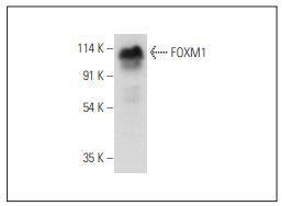 Anti-FOxM1 Antibody (6G924)