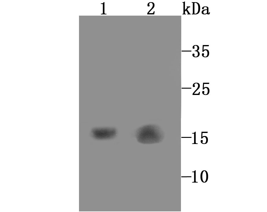 Anti-GABARAP Antibody (1D418)
