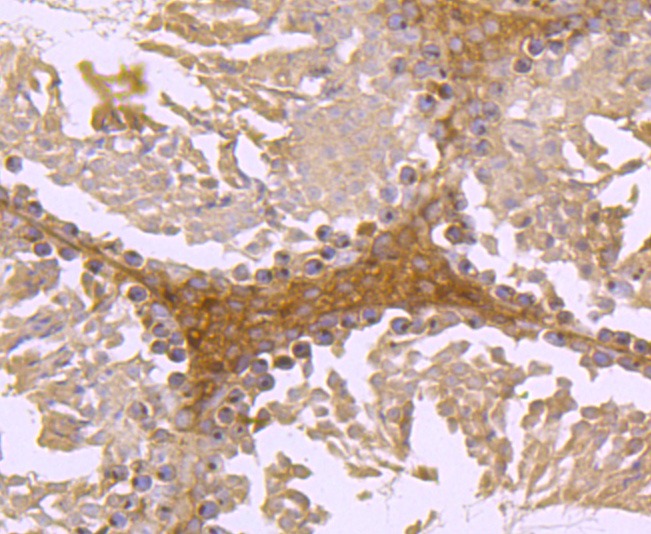 Anti-FGFR3 Antibody (4S518)
