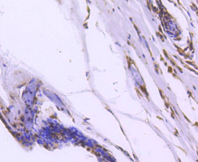 Anti-FOXO1 Antibody (6M554)