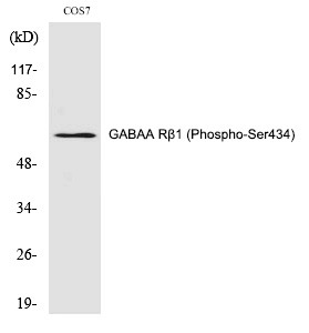 Anti-Phospho-GABAA Rβ1 (Ser434) Polyclonal Antibody
