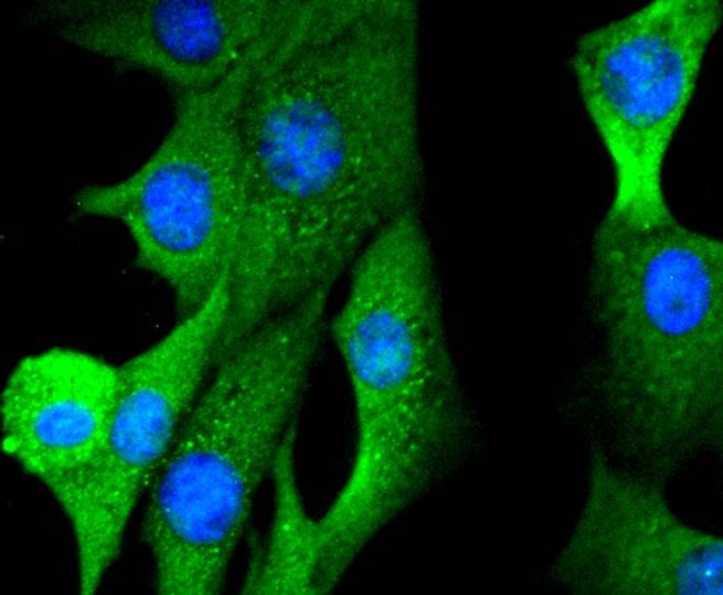 Anti-FOXO1 Antibody (6M554)