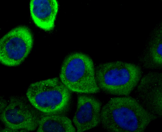 Anti-LGALS1 Antibody (2V443)