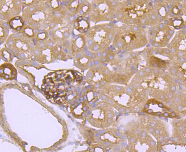 Anti-FGFR3 Antibody (4S518)