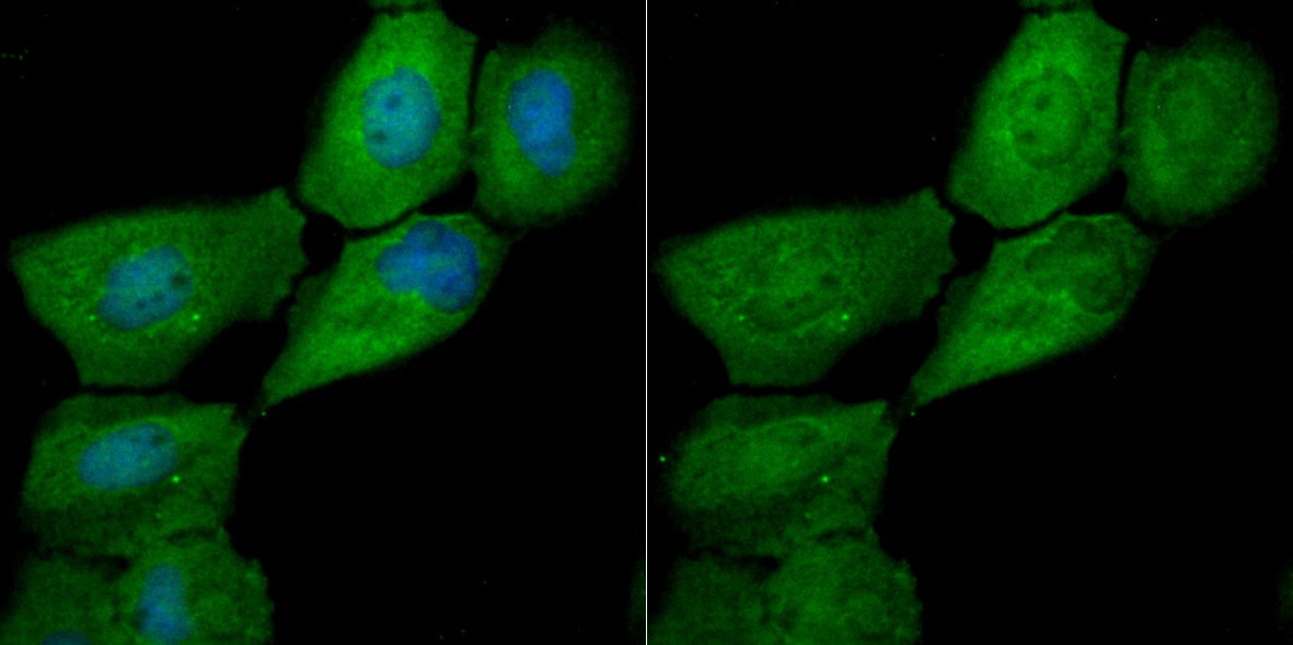 Anti-LGALS7 Antibody (2U199)