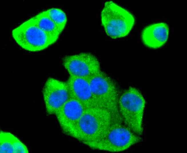 Anti-FOXO1 Antibody (6M554)