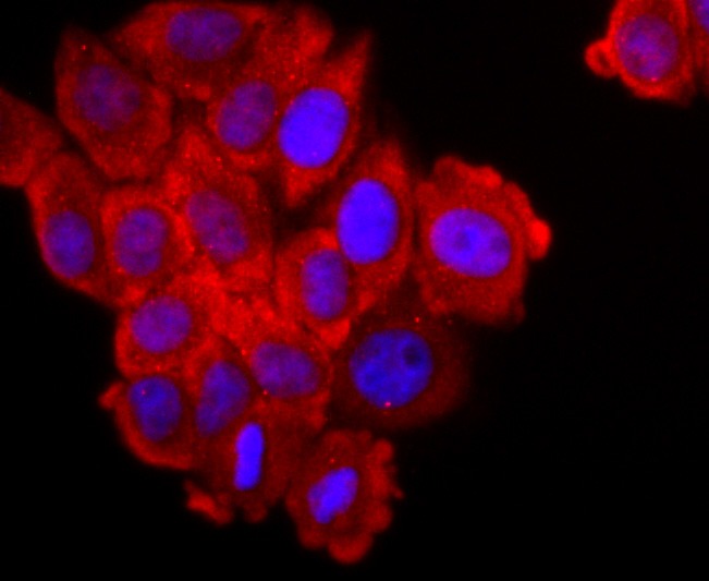 Anti-FGFR3 Antibody (4S518)