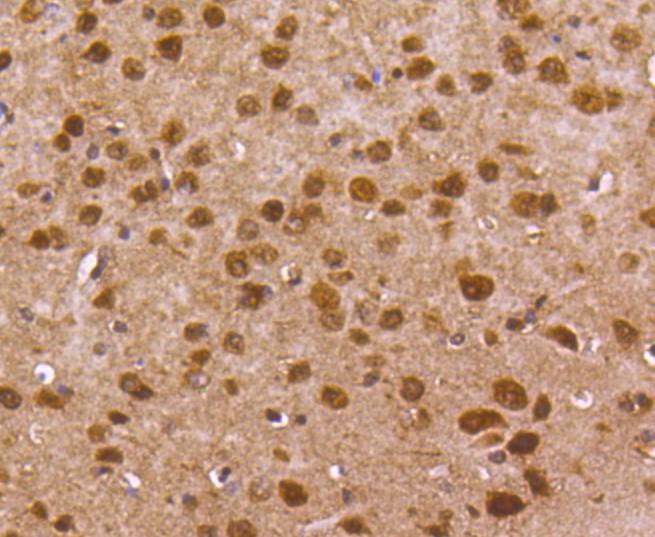 Anti-FOXO1 Antibody (6M554)