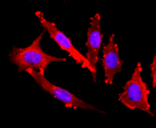 Anti-FGFR3 Antibody (7I878)