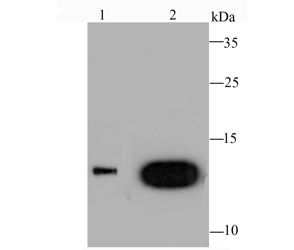 Anti-LGALS1 Antibody (2V443)