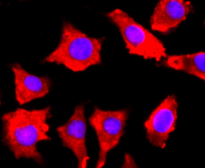 Anti-FGFR3 Antibody (4S518)