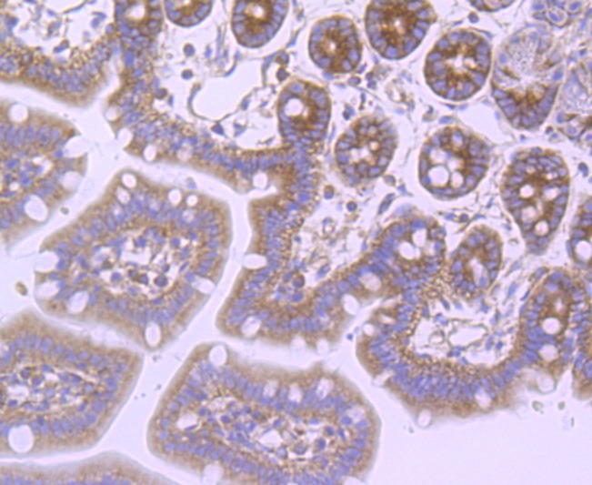 Anti-FMR1 Antibody (9X925)