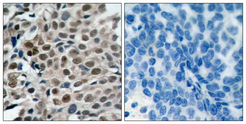 Anti-Phospho-FOXO3 (Ser253) Polyclonal Antibody 2