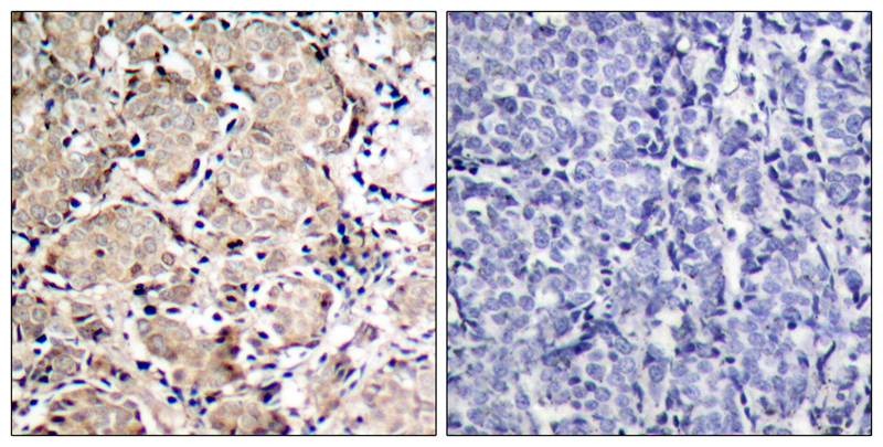 Anti-Phospho-FKHR (Ser319) Polyclonal Antibody