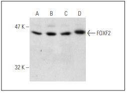 Anti-FOXF2 Antibody (8Y605)