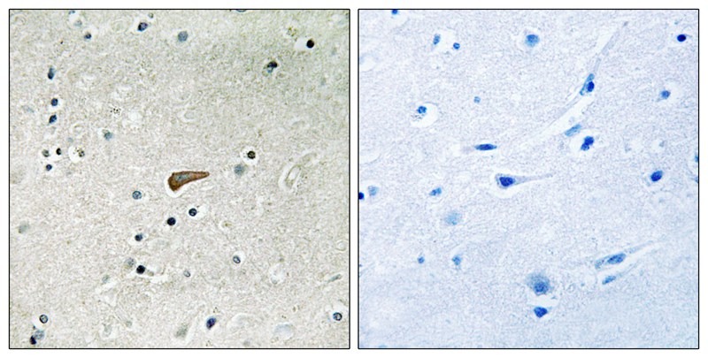 Anti-Phospho-FRS2 (Tyr436) Polyclonal Antibody