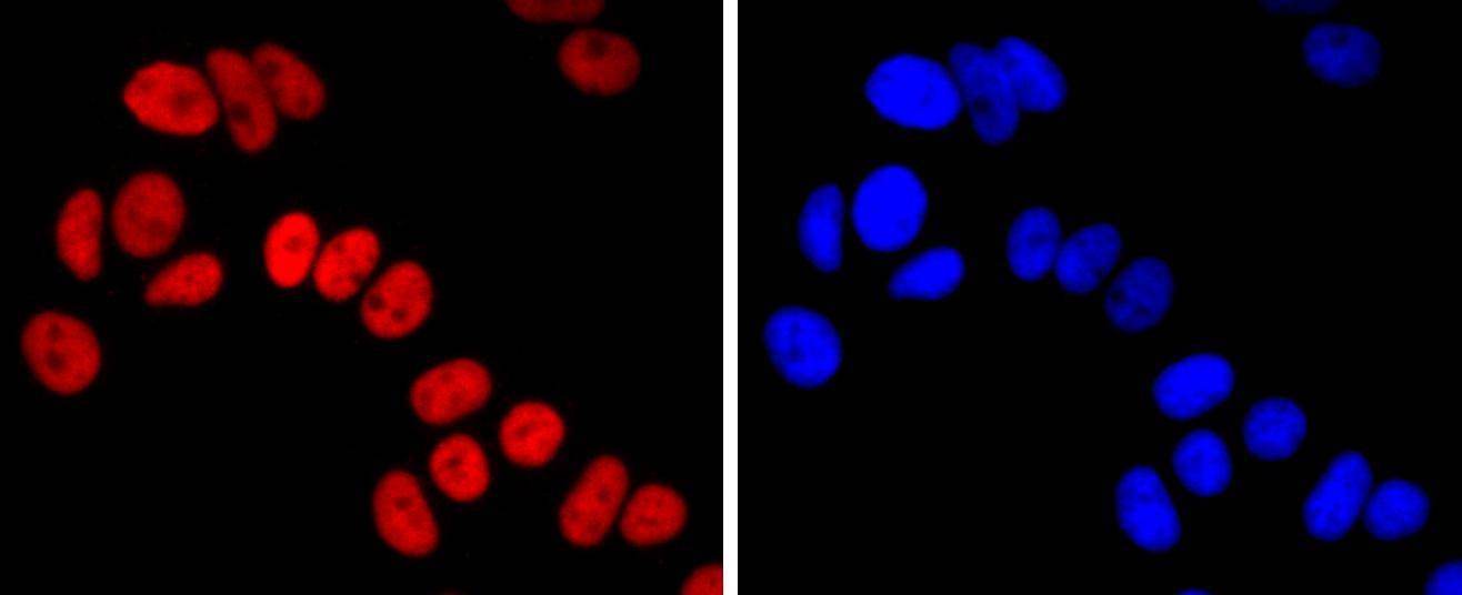 Anti-FOXA1 Antibody (5M374)