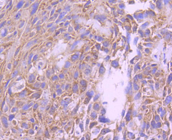 Anti-FOXO4 Antibody (2X512)