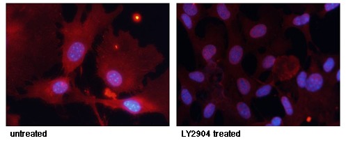 Anti-Phospho-FKHR (Ser256) Polyclonal Antibody
