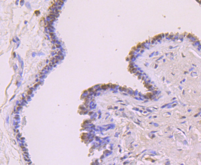 Anti-FOXP1 Antibody (1G20)